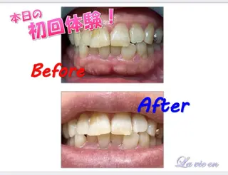 ホワイトニングサロン La vie enのその他イメージ