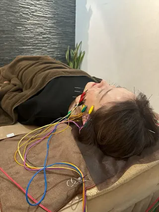 美容鍼灸整体サロンBeauJu所属・小顔矯/美容鍼/鍼灸 BeauJuのその他イメージ