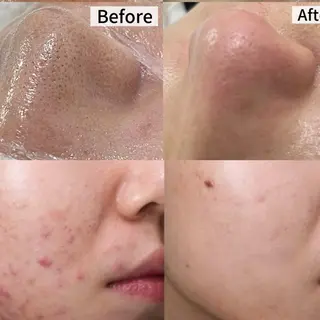 LUMINA ESTHのエステ・リラクイメージ