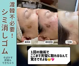 the 別嬪 静岡店のエステ・リラクイメージ