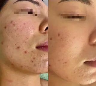 美肌ケアサロン iru【アイル】のエステ・リラクイメージ