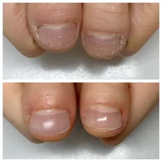 ネイル ネイルサロン アリュームのネイルデザイン
