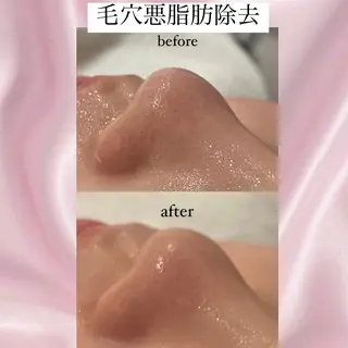 清水 恋のエステ・リラクイメージ