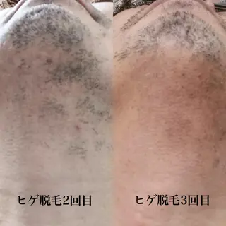 自由が丘 ビューティーラウンジの眉毛・アイブロウイメージ