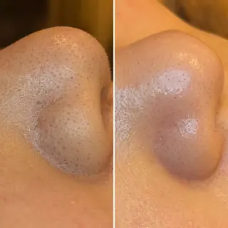 アイスリーサロン所属・毛穴改善サロン アイスリーのエステ・リラクイメージ