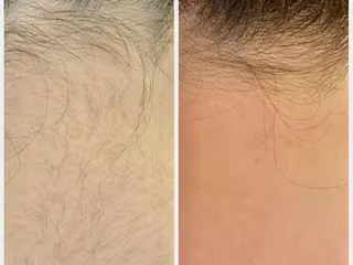 Dahliaダリア シュガーリングサロンのエステ・リラクイメージ