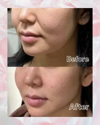 ショート aliaハーブ水光店 エステティシャン募集のエステ・リラクイメージ