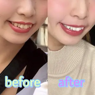 ホワイトニング専門店 LCS 汐留店 森田のその他イメージ