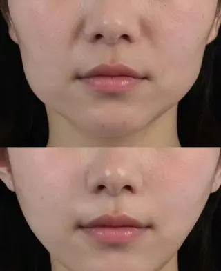 マツエク・マツパ aliaハーブ水光店 エステティシャン募集のエステ・リラクイメージ