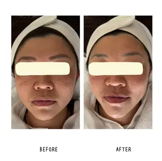 grow所属・Yoshino Erinaのエステ・リラクイメージ