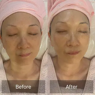 Lis Rose🥀 フェイシャルサロンのエステ・リラクイメージ