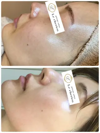 Le cherien ルシェリアのエステ・リラクイメージ