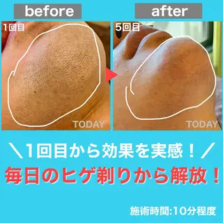 メンズ 都度払い制メンズ脱毛 オーナーのエステ・リラクイメージ