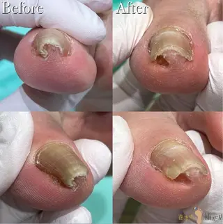 巻き爪アカデミー 溝の口のネイルデザイン