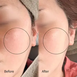 abbellina×uno所属・Anna / 出雲・肌質改善のエステ・リラクイメージ