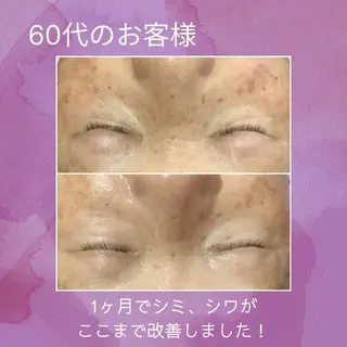 エステティックジュビラン【アメジスト】所属・アメジスト 松原あんなのエステ・リラクイメージ