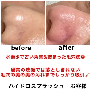 ネイル・エステサロン UILANIのネイルデザイン