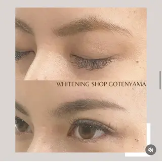 ホワイトニングショッ 吉祥寺2号店のその他イメージ