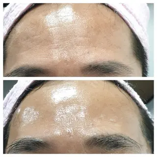 ナスサロ所属・韓国式肌改善 ナスサロ/RuRuのエステ・リラクイメージ