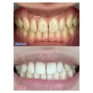 Ｍ渋谷 ホワイトニングのエステ・リラクイメージ