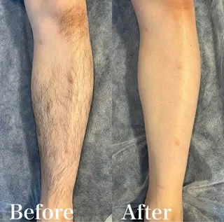 メンズ wax脱毛専門店 ハイラントのエステ・リラクイメージ