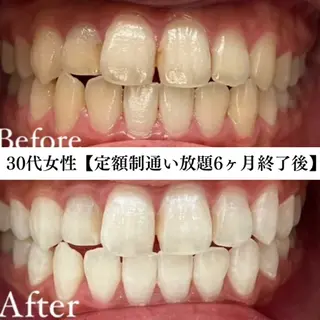 キッズ メンズ セルフホワイトニング WHITE福岡天神店のエステ・リラクイメージ