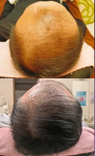 メンズ LOUISE. ／肌質・頭皮のエステ・リラクイメージ