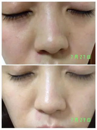 メンズ 朝重い人専用 肩甲骨調整のエステ・リラクイメージ