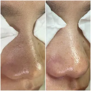 毛穴洗浄専門店/ 泉佐野/oluoluのエステ・リラクイメージ