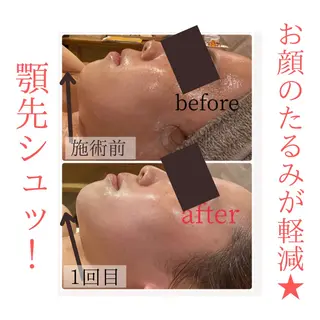 アンジュ 園田のネイルデザイン