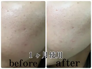 POLA The Beauty印場店のエステ・リラクイメージ