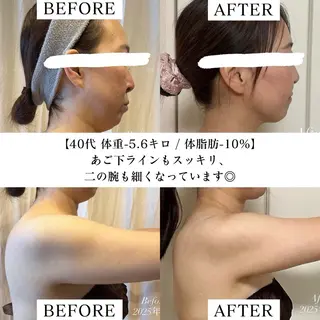 【目黒】本格痩身✴︎ 最新型よもぎ蒸しのエステ・リラクイメージ