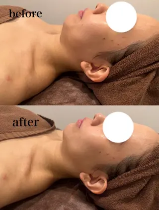 【都度払い専門店】 エステサロARTI,のエステ・リラクイメージ