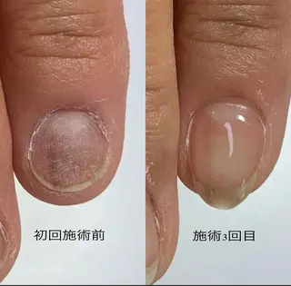 ネイル M nailのネイルデザイン