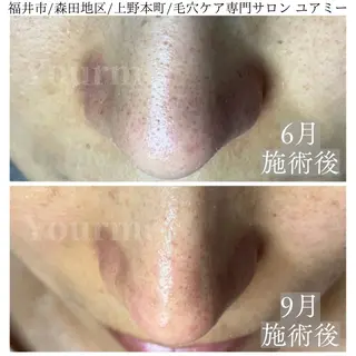毛穴肌質ケアサロン Yourmeユアミーのエステ・リラクイメージ