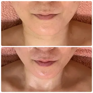 Suite Coutureのエステ・リラクイメージ