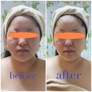 エステティック Nanagiのエステ・リラクイメージ