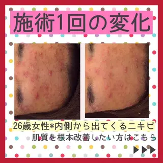 ミディアム カラー パーマ ヘアアレンジ メンズ キッズ ネイル マツエク・マツパ ニキビ・肌質改善専門 ♡人生が変わるサロンのエステ・リラクイメージ