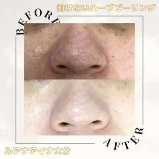 ルアナアイナ 大分のエステ・リラクイメージ