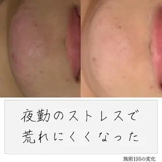 ニキビ経験者が施術 する専門サロン🌻のエステ・リラクイメージ