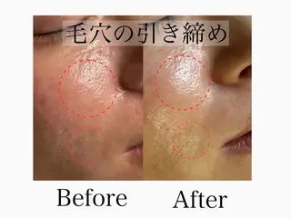 六本木/似合わせ眉毛 andＳ🍀Yuriのエステ・リラクイメージ