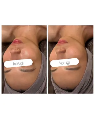 小顔コルギ ☆表参道/外苑前のエステ・リラクイメージ