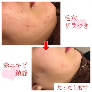 セミロング カラー パーマ ヘアアレンジ メンズ キッズ ネイル マツエク・マツパ 金の糸脱毛 産毛ケア専門のエステ・リラクイメージ