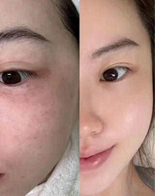 マツエク・マツパ 愛維美水光美肌専門店 メンズレディースokのエステ・リラクイメージ