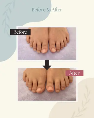 足トラブル専門 ニコルル金沢のエステ・リラクイメージ