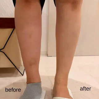 アイアンド ネイルデイのエステ・リラクイメージ