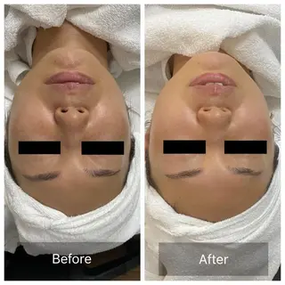 9D焦点式美容⚜️ Desafio 笹川のエステ・リラクイメージ