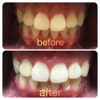 two nailのネイルデザイン