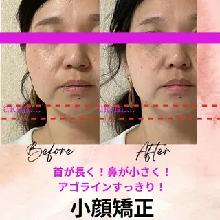 LUMINAルミナ 【肌管理サロン】のその他イメージ