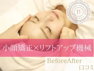 小顔/毛穴/ニキビ salon bealのエステ・リラクイメージ
